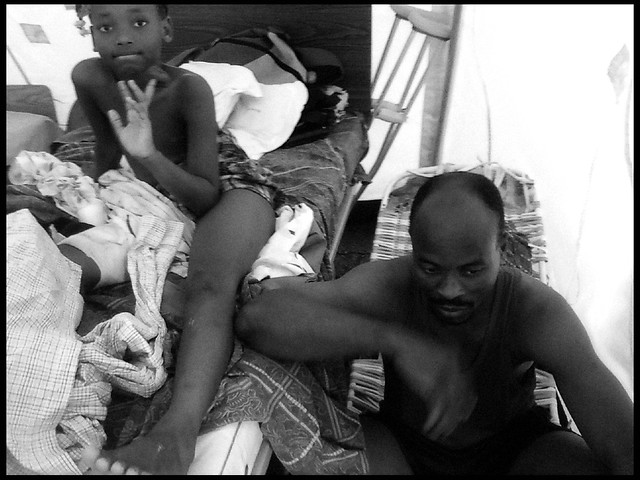 10 year Haiti earthquake anniversary/Injured girl, HUEH - General Hospital, Haiti
