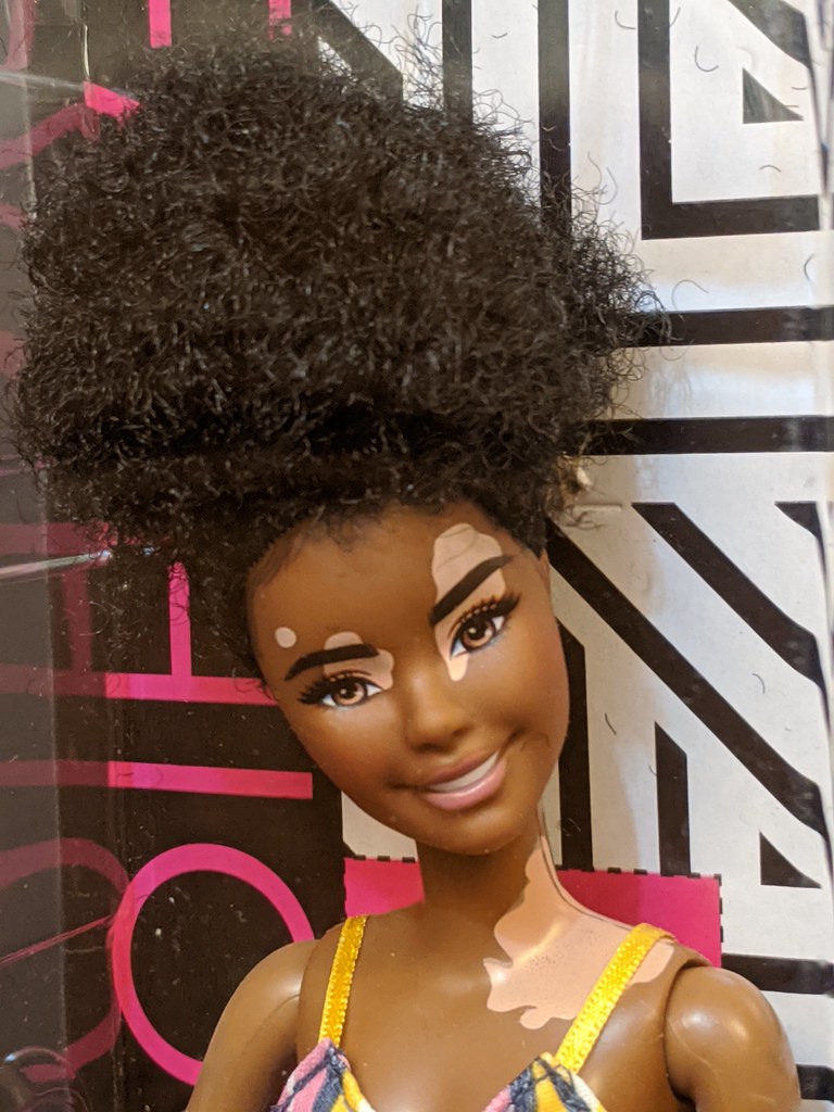 Barbie GHW51 Fashionistas Doll with Vitiligo and Curly Brunette Hair NEW 