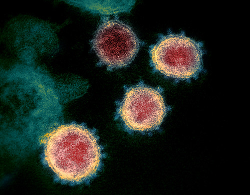Novel Coronavirus SARS-CoV-2 | by NIAID