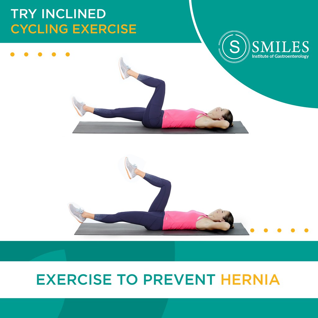 Inclined Cycling to prevent Hernia - SMILES Bangalore