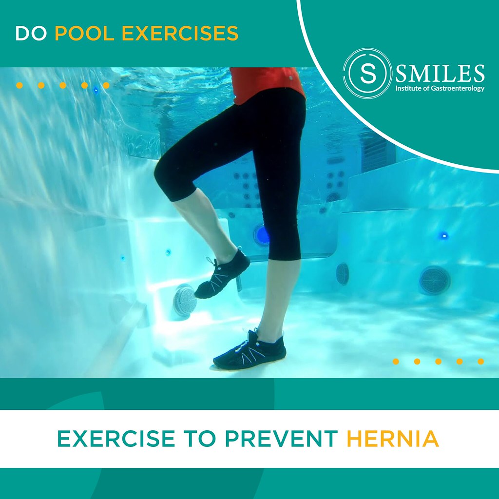 Pool Exercises to prevent Hernia