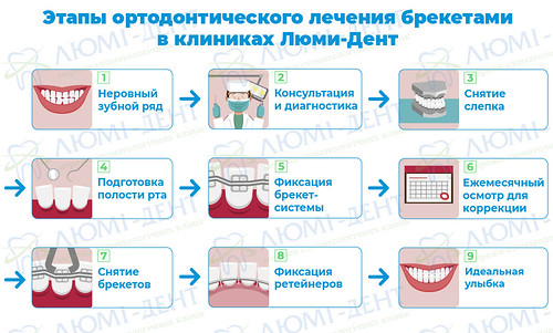 Этапы ортодонтического лечения брекетами в клиниках Люми-Дент