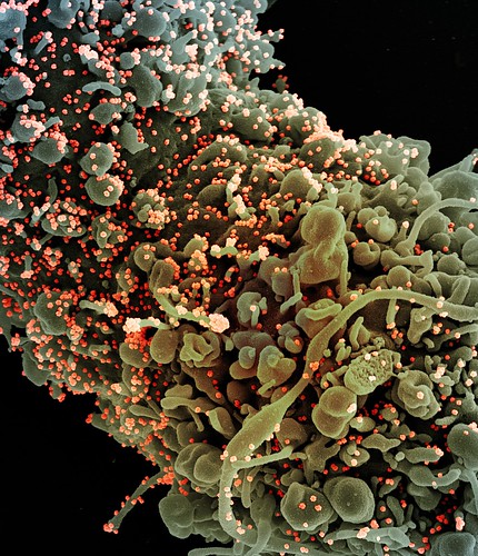 Novel Coronavirus SARS-CoV-2 | by National Institutes of Health (NIH)