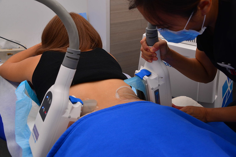 CoolSculpting at Halley Medical Aesthetics