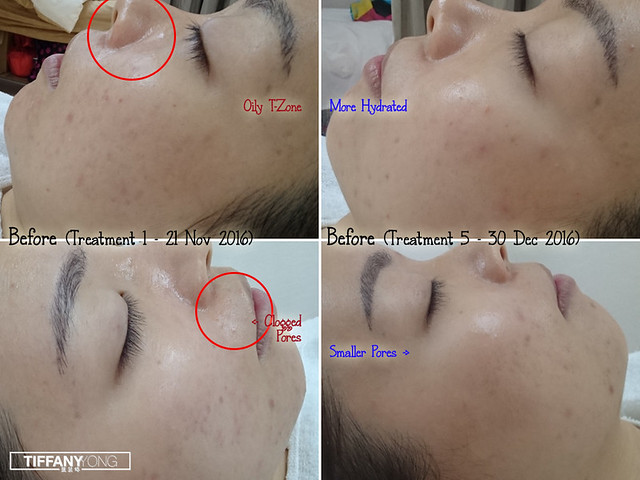 Skin Science Forlled Results 2