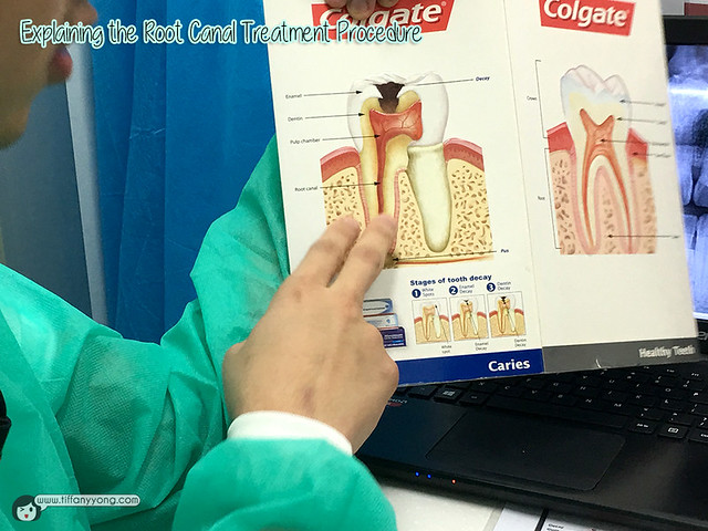 icare-dental-tooth-structure