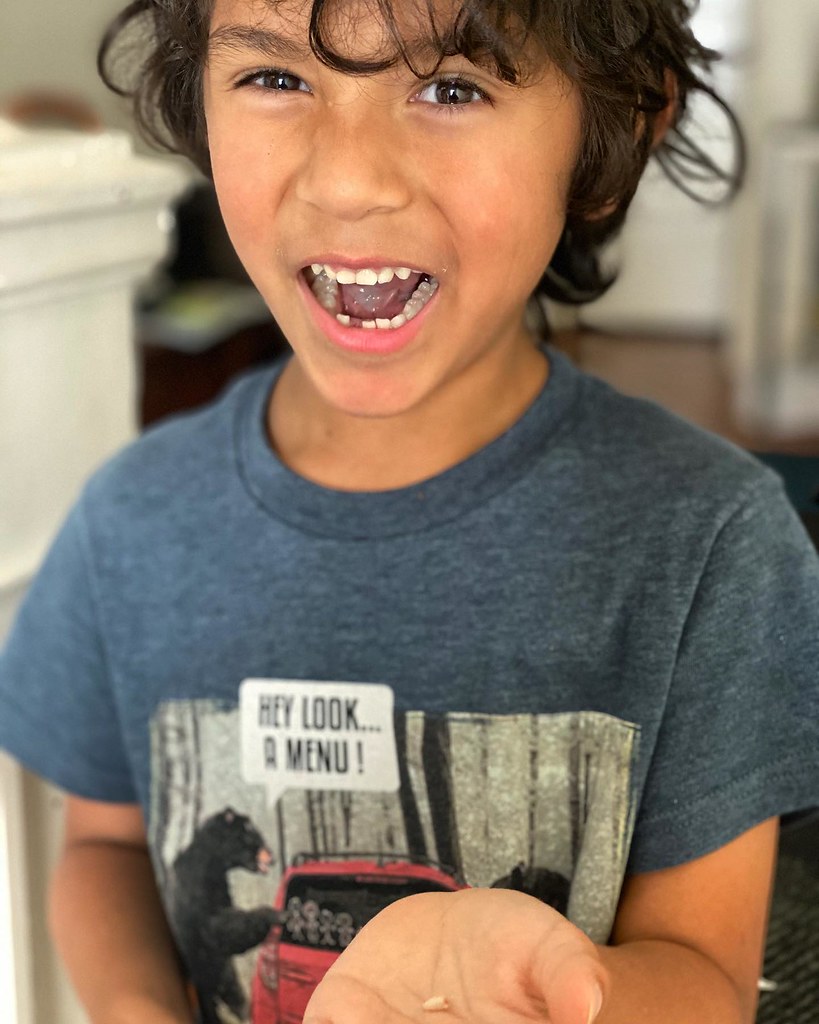 First Tooth Lost Today!