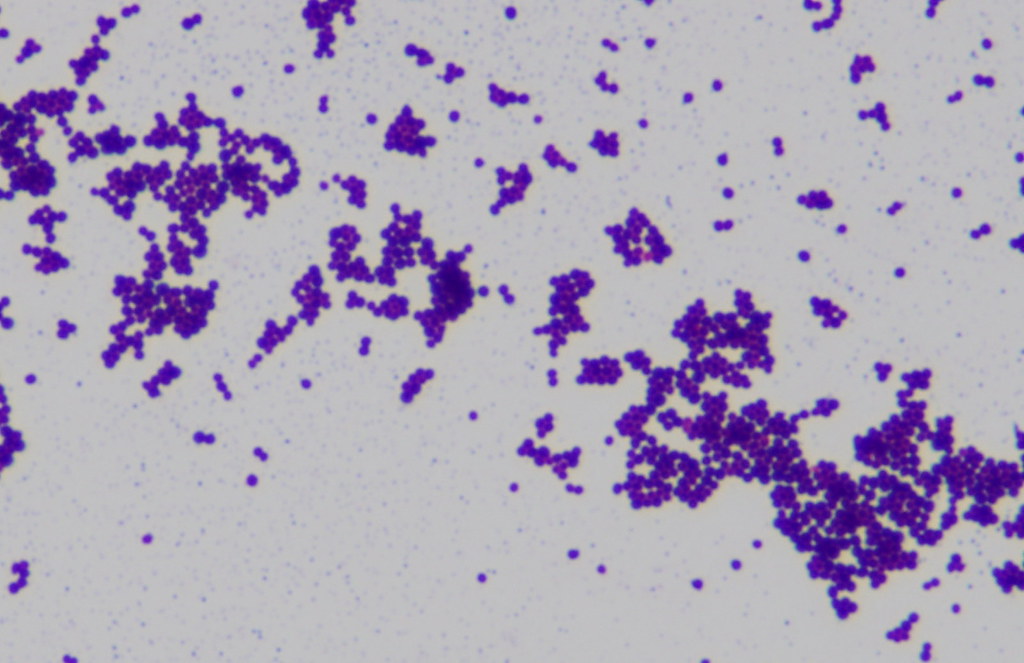 File:Staphylococcus aureus Gram stain.jpg - Wikimedia Commons