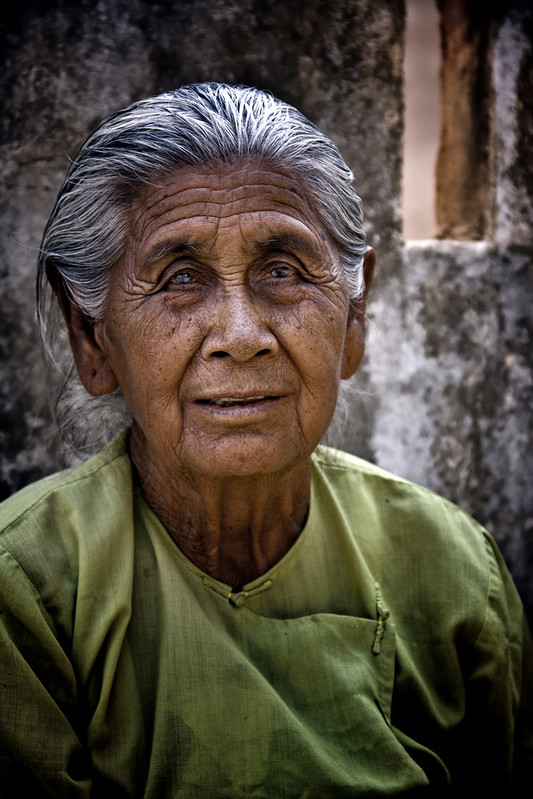 A Venerable Burmese Lady With Cataracts