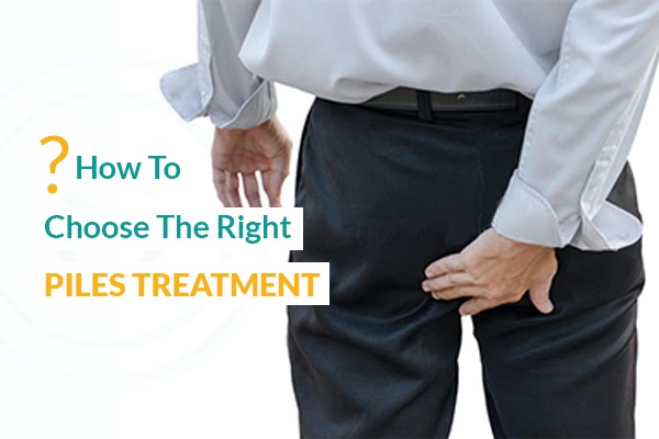 How to choose the Right piles Treatment