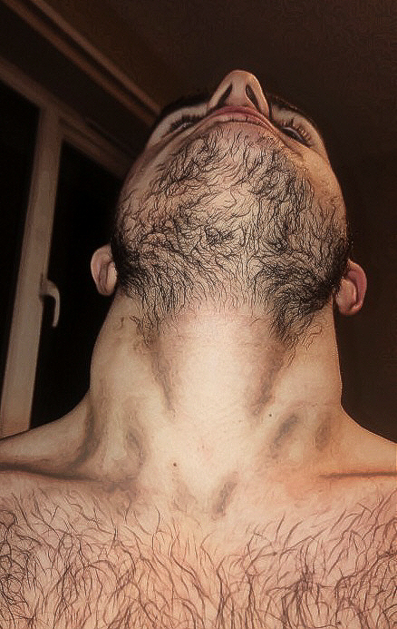 Male neck