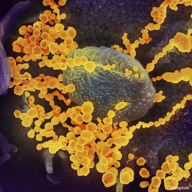 Novel Coronavirus SARS-CoV-2–This scanning electron microscope image shows SARS-CoV-2 (round gold objects) emerging from the surface of cells cultured in the lab. SARS-CoV-2, also known as 2019-nCoV, is the virus that causes COVID-19. Original image