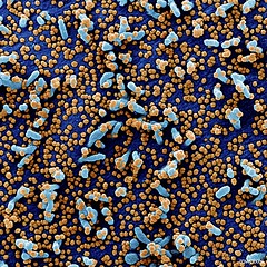 Novel Coronavirus SARS-CoV-2&ndash;Colorized scanning electron micrograph of a VERO E6 cell (blue) heavily infected with SARS-COV-2 virus particles (orange), isolated from a patient sample. Original image sourced from US Government department: The Nationa