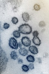 Novel Coronavirus SARS-CoV-2&ndash;This scanning electron microscope image shows SARS-CoV-2&mdash;also known as 2019-nCoV, the virus that causes COVID-19. Original image sourced from US Government department: The National Institute of Allergy and Infectio