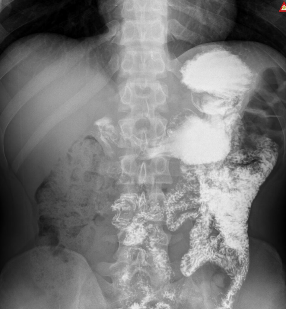 X-ray abdomen image