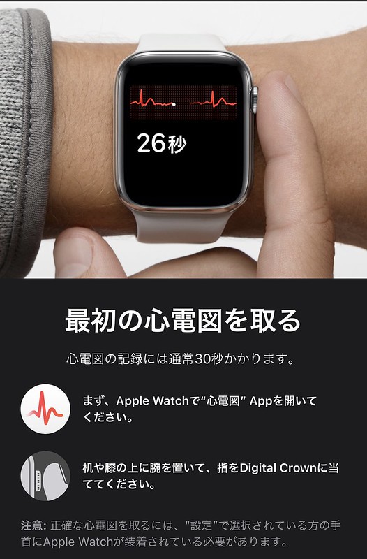 electrocardiogram on Apple Watch