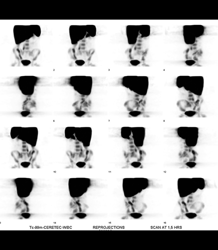 Nuclear Medicine Sample Image