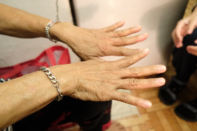 在九龍城租住約4年、現年68歲的泰裔街坊森宋展示因工作變形的雙手