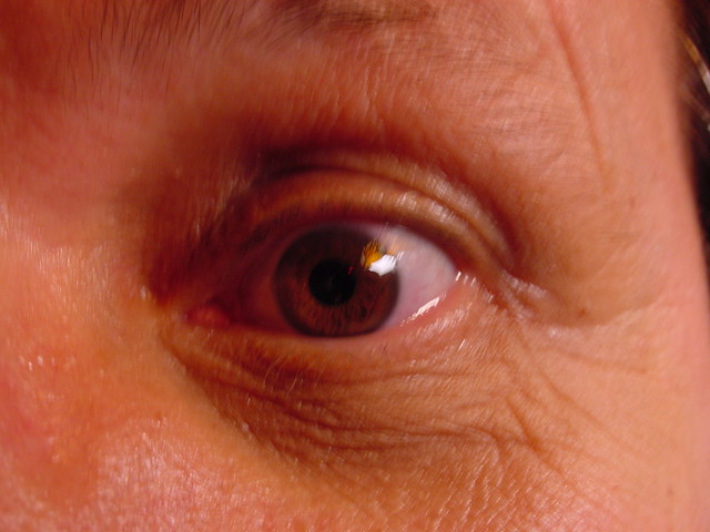 2004.12.035_Jack's eye