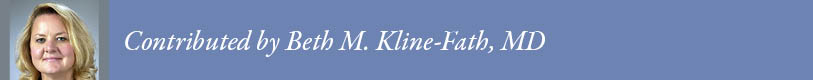 Kline-Fath template