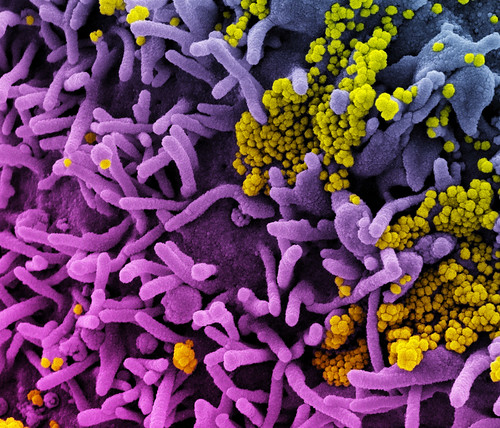 Novel Coronavirus SARS-CoV-2