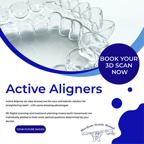 Active Aligners | Active Aligners (or clear braces) are the … | Flickr