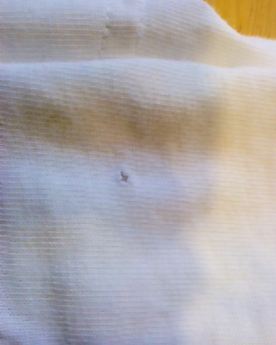 Close-up of a hole in a piece of clothing.