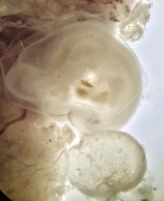 Embryo approximately 5-6 weeks