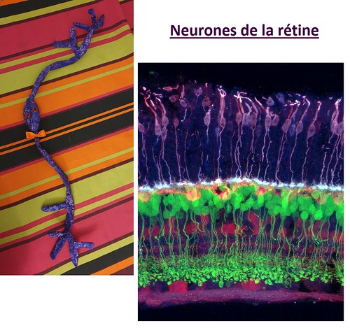 Neurone de la rétine + photo