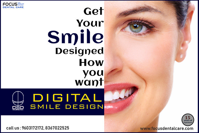 Digital Smile Design in Hyderabad