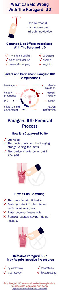 What Can Go Wrong With The Paragard IUD (Infographic)