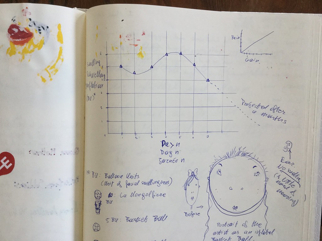 20180908 1051 - Claire's FFS - 11 - day 5 - 2Pass journal - graph of swelling - 21511038