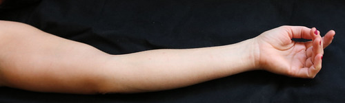 Arm Reference #53
