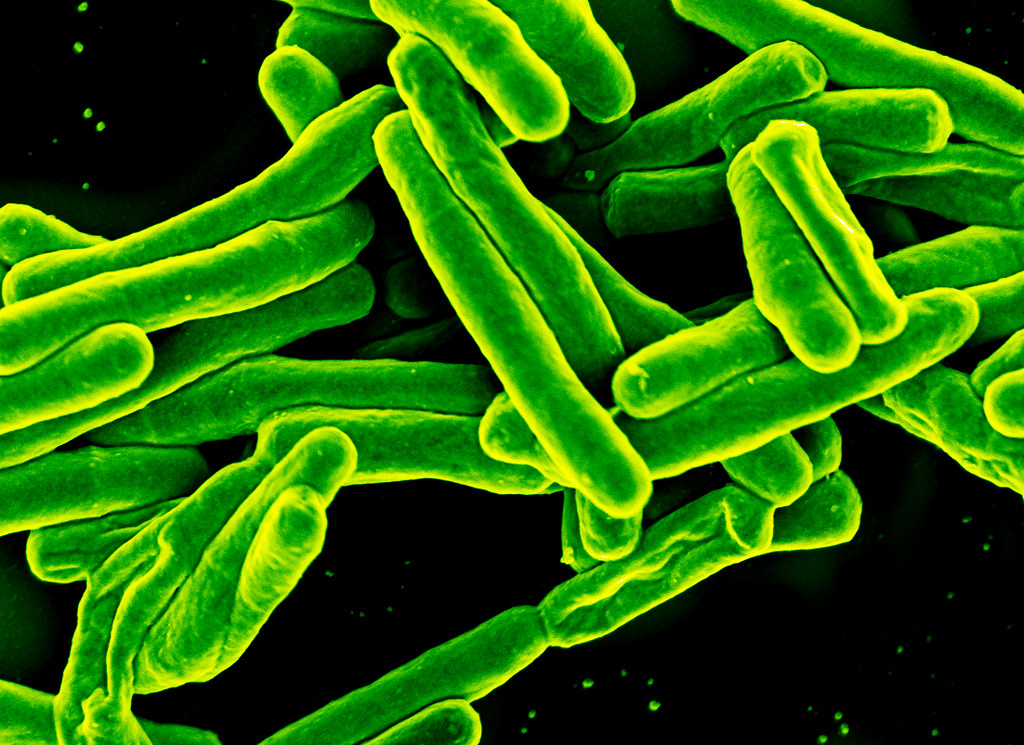 Mycobacterium tuberculosis Bacteria, the Cause of TB | Flickr