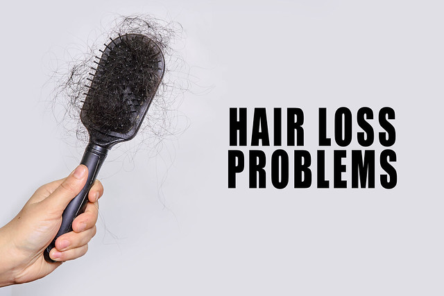 Woman holds a black comb with lost hairs. Hair loss problems.