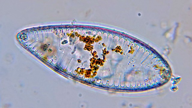 Cymbella sp. - Diatomée