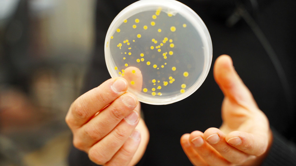 close up of hands holding up a petri dish that is growing bacteria
