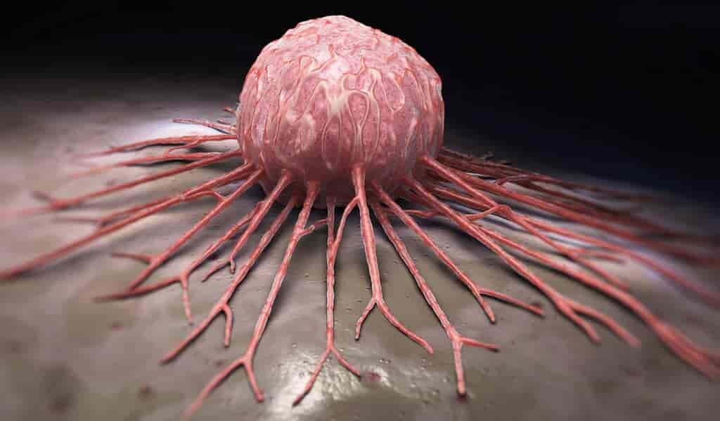 une-nanoparticule-per-un-une-attaque-2-en1-contre-le-cancer