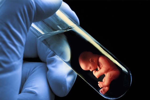 Consult the Reliable Test Tube Baby Center in Delhi Now
