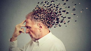 Alzheimer, scoperti altri 40 fattori di rischio. Verso la sperimentazione di nuovi farmaci 