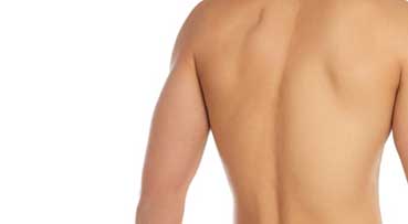 Early detection for Scoliosis to avoid surgical treatment