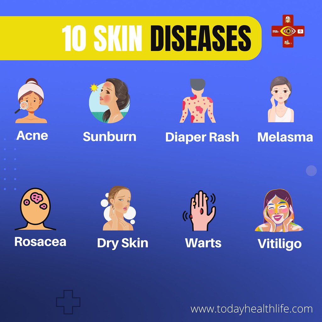 10 skin diseases