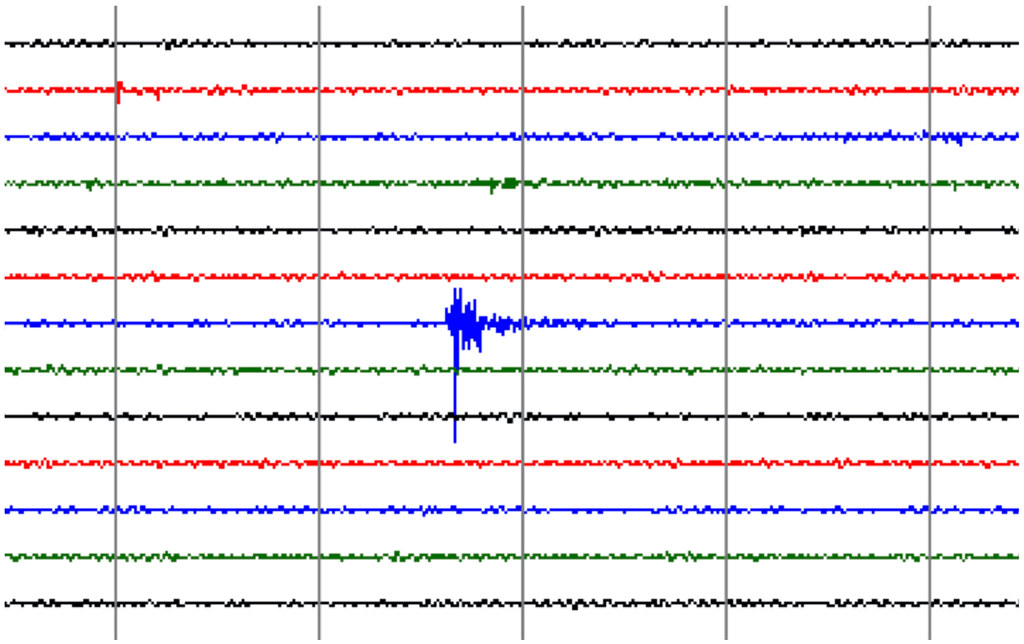 West Virginia magnitude 2.0 earthquake (8:36 PM, 9 August 2022)