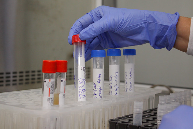 Laboratório público do DF inicia testagem da monkeypox