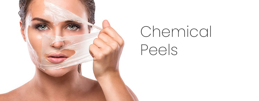 chemical-peels-banner