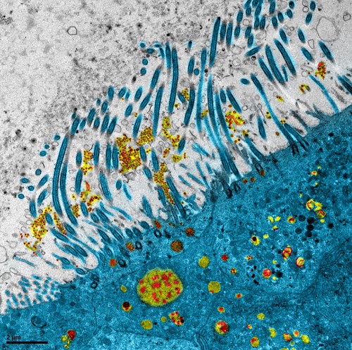 Epithélium respiratoire humain infecté par le SARS-CoV-2 | by inserm