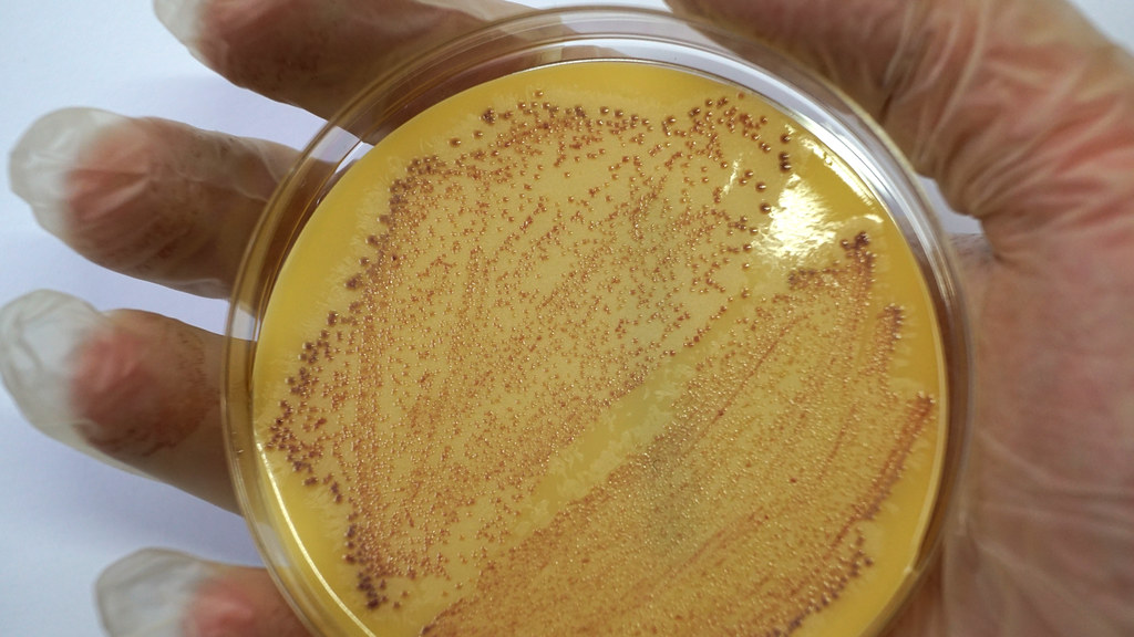 Petri dish with Staphylococcus aureus culture. MRSA test.