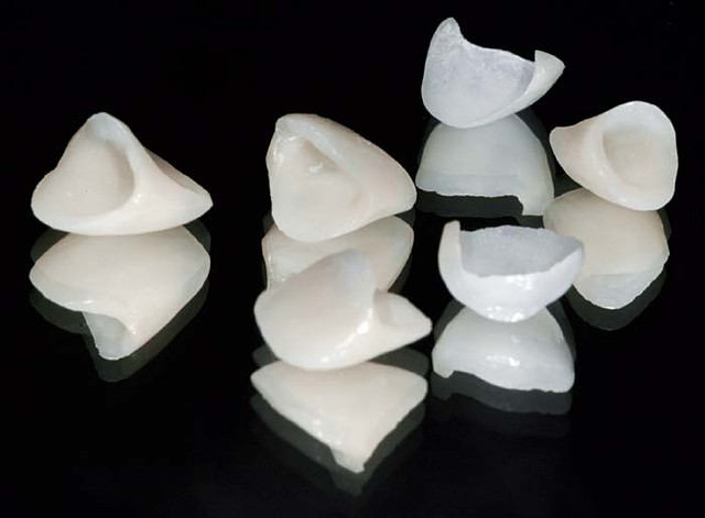 chất liệu răng sứ veneer
