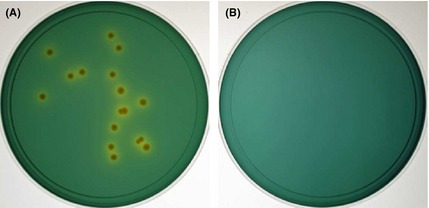 Colony-formation-of-VBNC-Vibrio-cholerae-O139-on-F-TCBS-plates-Aliquots-01mL-of-VBNC