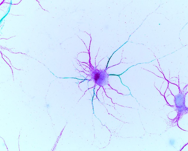 Neurones d'hippocampe de rat déficients pour la protéine anykrine